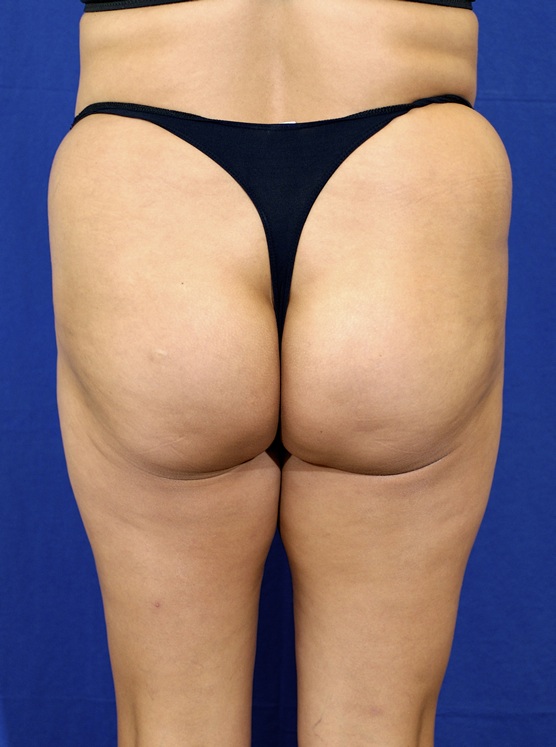 S-Back Image