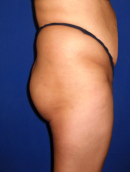 S-Back Image