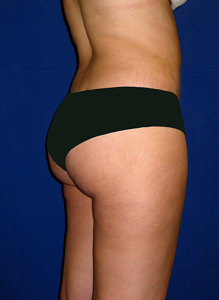 S-Back Image