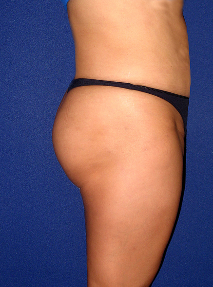 S-Back Image