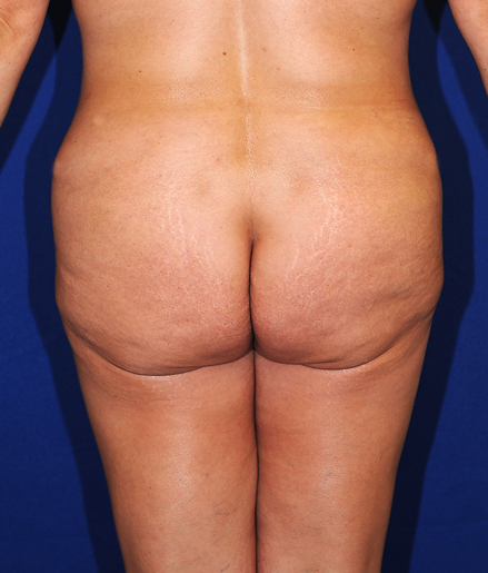 S-Back Image