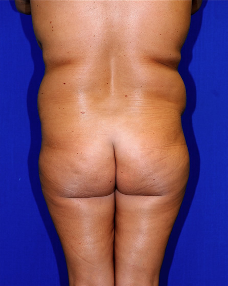 S-Back Image